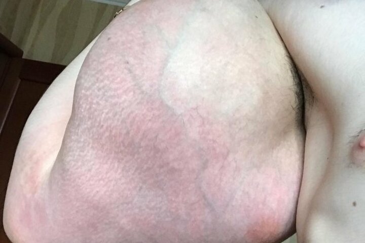 21