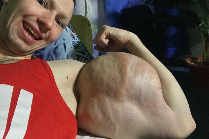 33