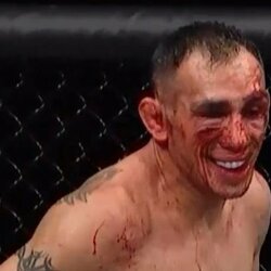Tony Fergusonas prieš Justiną Gaethje | „X“ nuotr. 1