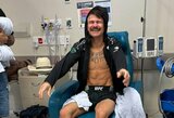 Kova dėl UFC čempiono titulo Diego Lopesui pareikalavo abiejų lūžusių pėdų
