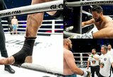 „Glory 100“ turnyre iš kalėjimo išėjęs legendinis kovotojas patyrė kraupią traumą: „Tikiuosi, kad tai ne paskutinis kartas“