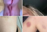 M.Greenwoodo mergina H.Robson paviešino vaizdo įrašus ir nuotraukas: apkaltino futbolininką smurtu ir seksualine prievarta
