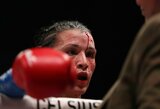 „Niekas nenori, kad kova baigtųsi tokiu būdu“: UFC legendos viltis tapti pasaulio bokso čempione sudaužė varžovės žaizda