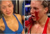 Brutalią kovą pralaimėjusi P.Gonzalez: „Daugiau kovose be pirštinių nedalyvausiu“