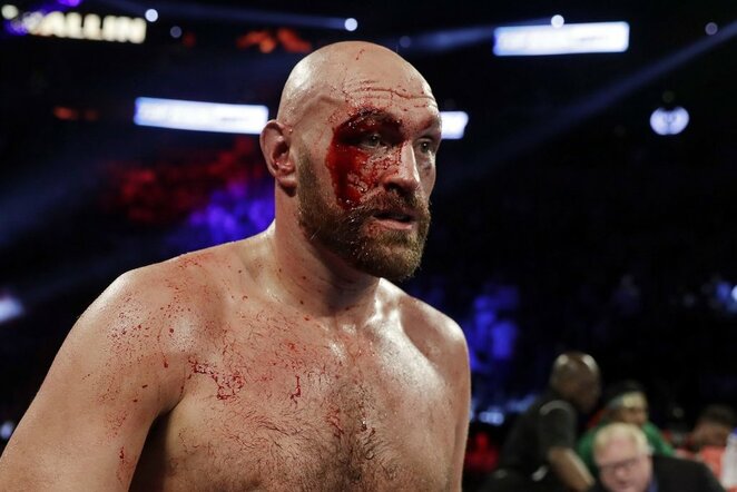 Tysonas Fury | Scanpix nuotr.