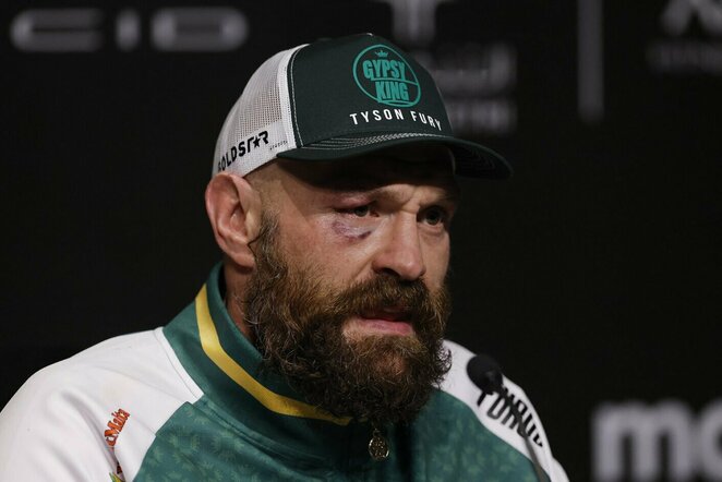 Tysonas Fury | Scanpix nuotr.