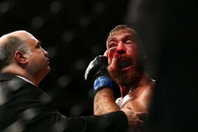 Donaldas Cerrone'as | Scanpix nuotr.