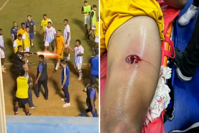 Incidentas Brazilijoje | Organizatorių nuotr.