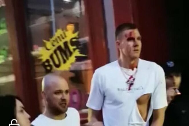 Kristapas Porzingis | „Stop“ kadras