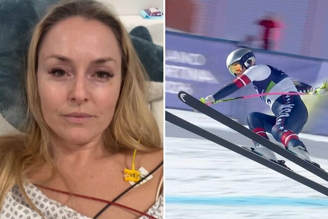 Lindsey Vonn | Scanpix nuotr.