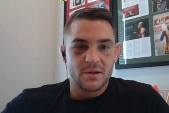Dustinas Poirier | Youtube.com nuotr.