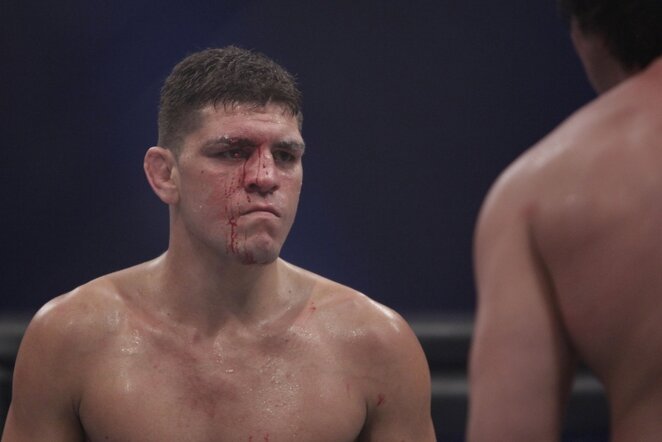 Nickas Diazas | AP/Scanpix nuotr.