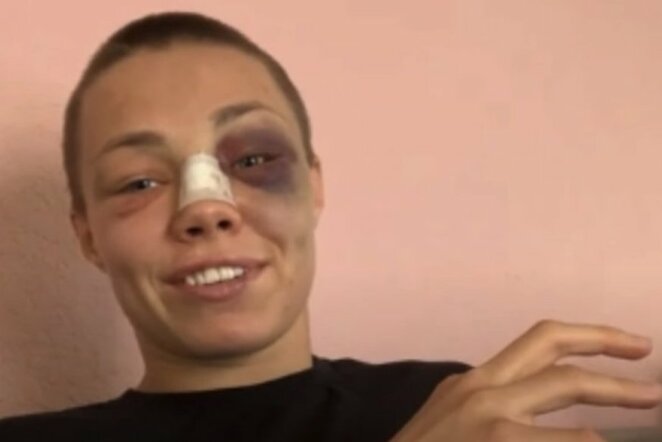 Rose Namajunas | „Stop“ kadras