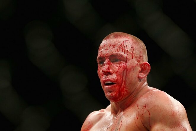 Georgesas St-Pierre'as prieš Michaelą Bispingą | Scanpix nuotr.