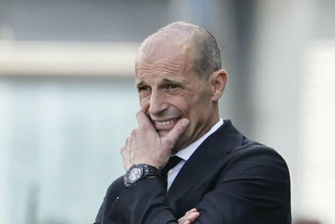 Massimiliano Allegri | EPA nuotr.