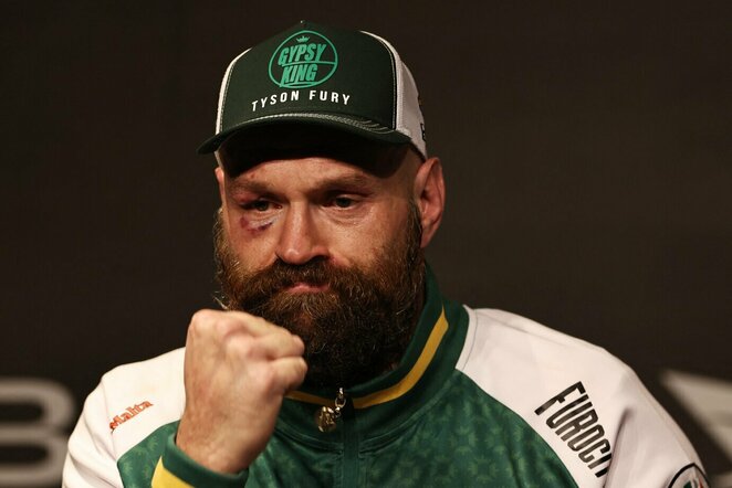 Tysonas Fury | Scanpix nuotr.