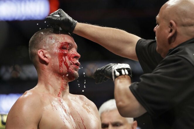 Nate'as Diazas | Scanpix nuotr.