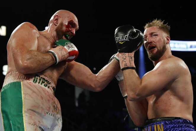 Tysonas Fury ir Otto Wallinas | Scanpix nuotr.