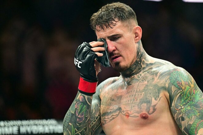 Tomas Aspinallas | Scanpix nuotr.