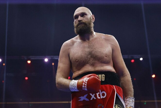Tysonas Fury | Scanpix nuotr.