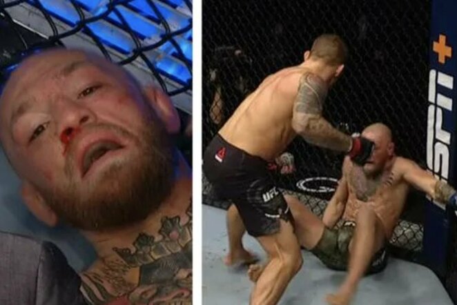 Dustinas Poirier prieš Conorą McGregorą | „Stop“ kadras