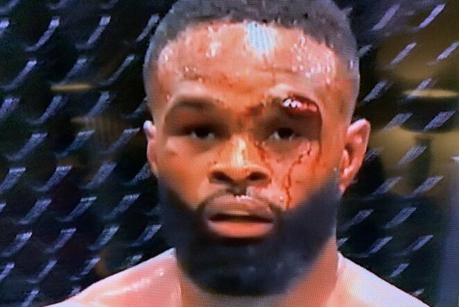 Prakirstas T.Woodley antakis | „Twitter“ nuotr.