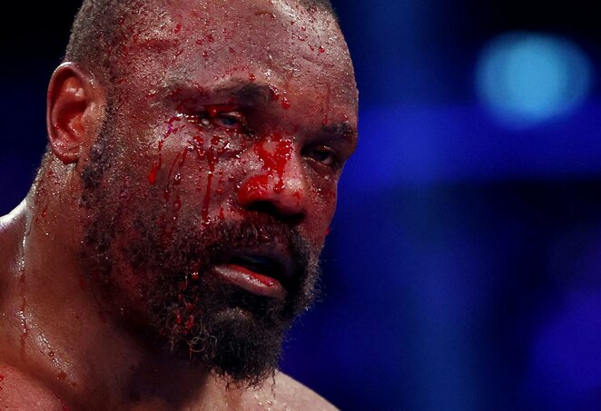 Derekas Chisora | Scanpix nuotr.