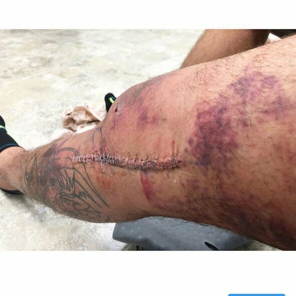 Tony Fergusono kelis | Instagram.com nuotr Tony Fergusono kelis | Instagram.com nuotr